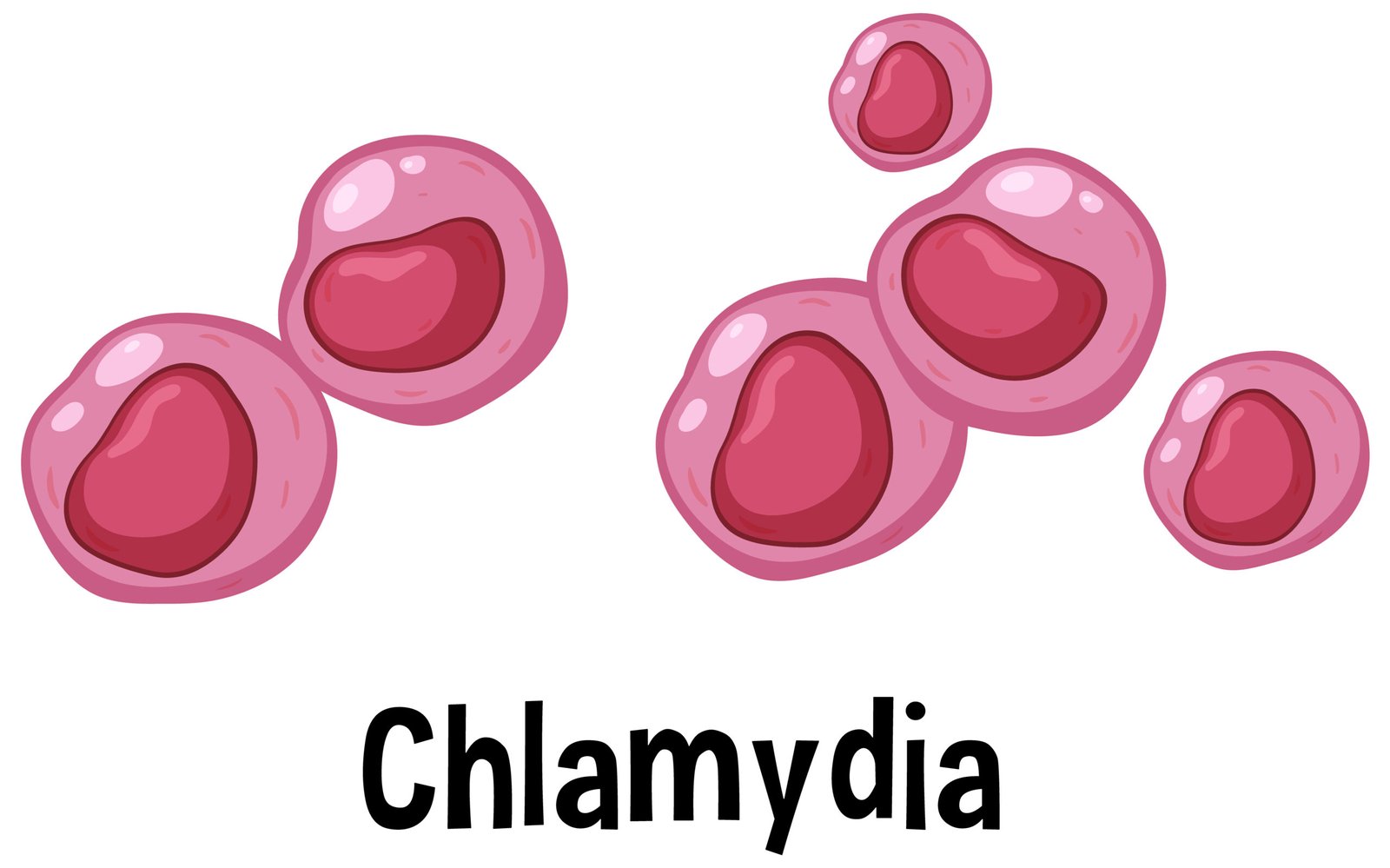 Chlamydia